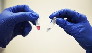 Chuẩn đoán ung thư bằng nước tiểu thông qua hạt nano